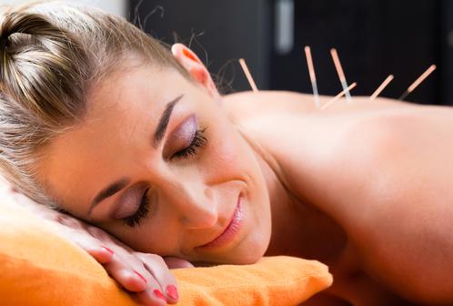 Patient relaxing during an acupuncture and myofascial release treatment in Nyack, NY